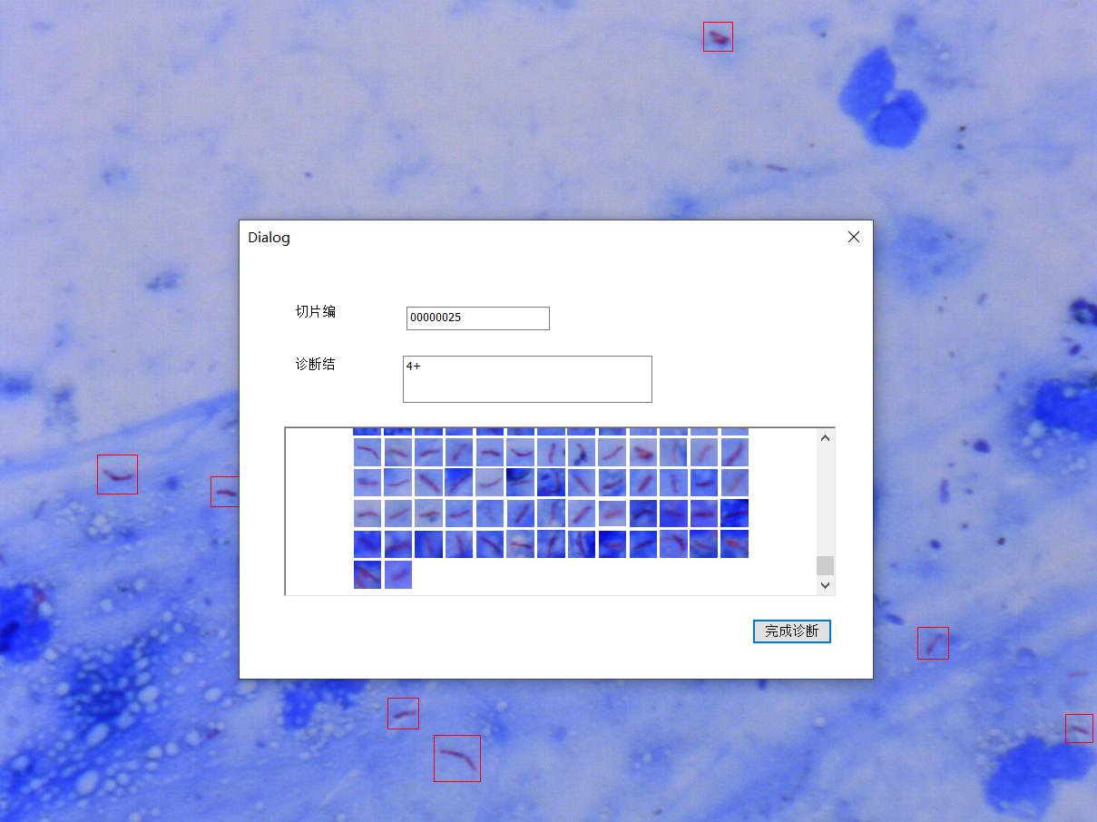 Scanpro3 Zihel-Neelsen Acid-fast Staning-Diagnostic Report