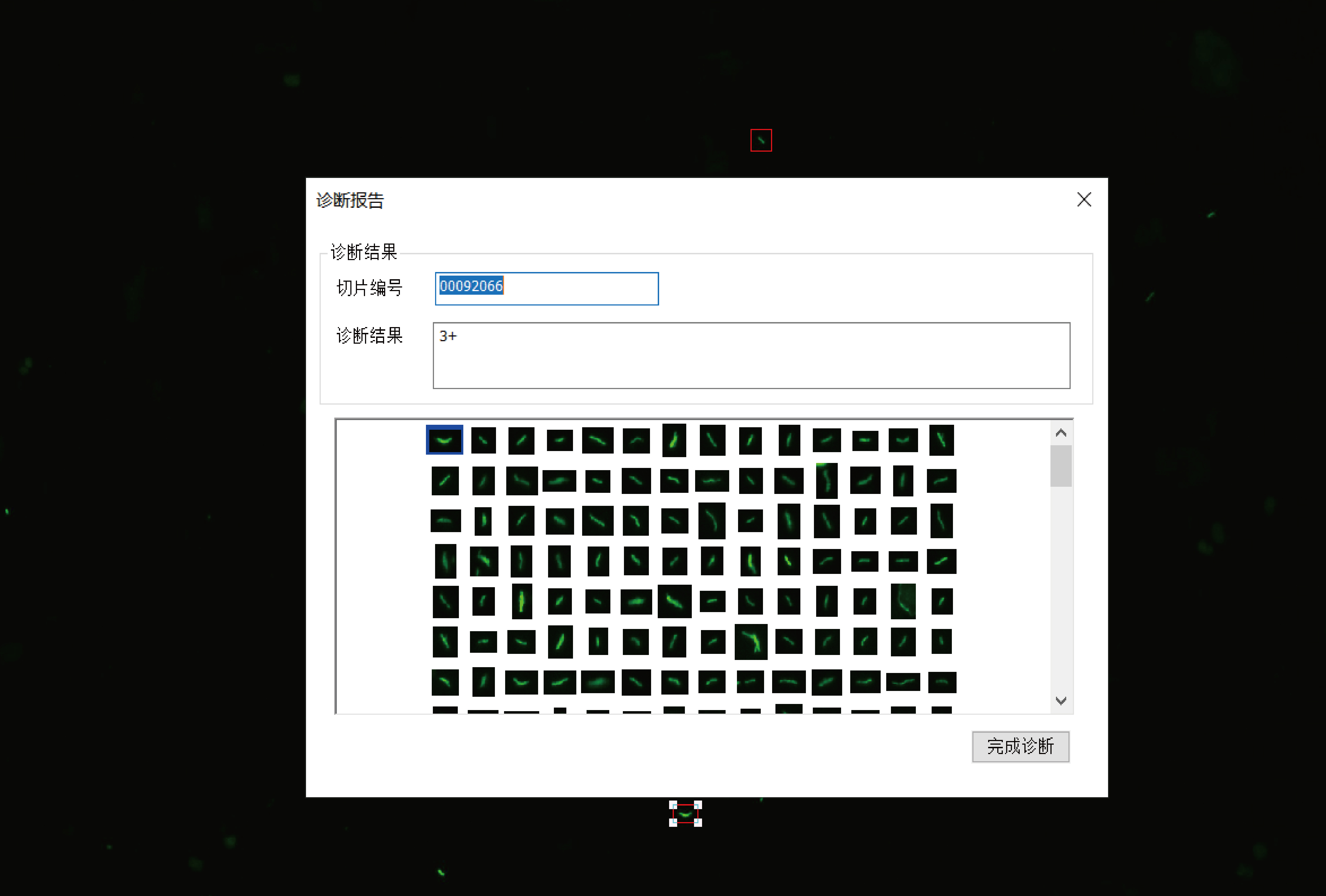 Scanpro3 Auramine O Staning-Intelligent Identification