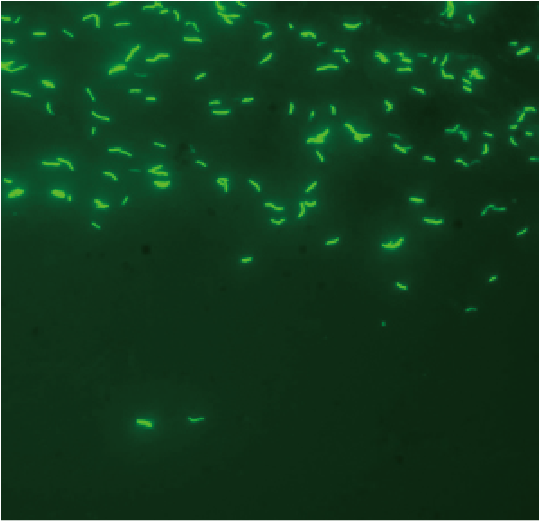 BSM Auramine Ostaining