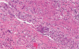 BSM Pathology