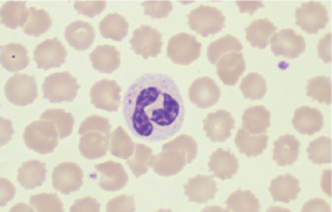 BSM Blood Cell Morphology Analysis