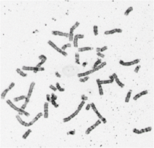 BSM Chromosome Karyotype Slide